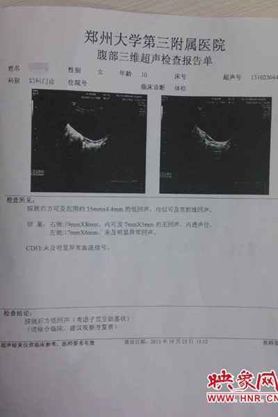 鄭州大學第三附屬醫(yī)院鑒定結果