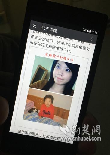 25歲少女患怪病“逆生長(zhǎng)” 半年矮了13厘米(圖)